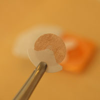 花粉症で使用する超微細鍼