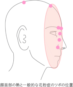 顔面部の熱と一般的な花粉症のツボの位置